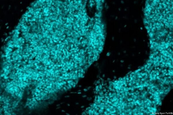 Scientists discover new ‘immune hubs’ in skull bone marrow