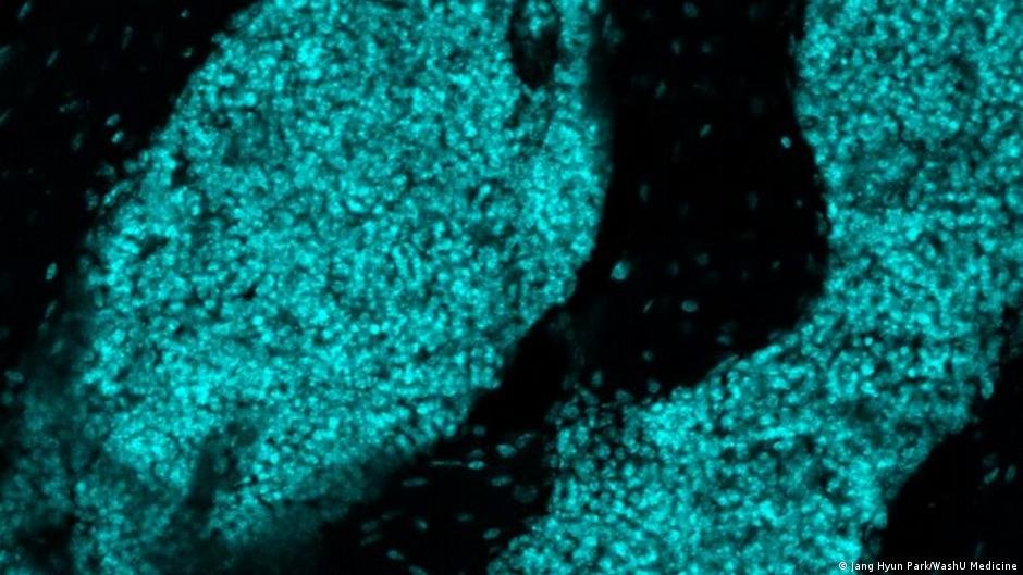 Scientists discover new ‘immune hubs’ in skull bone marrow